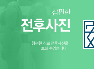 전후사진